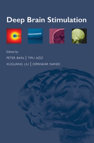 Imagen de portada: Deep Brain Stimulation 1st edition 9780199543717