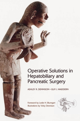 Immagine di copertina: Operative Solutions in Hepatobiliary and Pancreatic Surgery 9780199584178