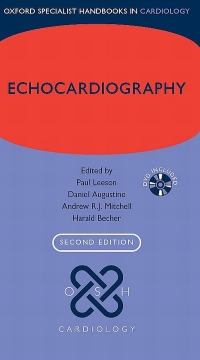 表紙画像: Echocardiography 2nd edition 9780199591794