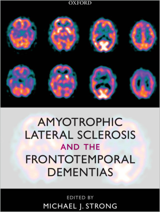 Cover image: Amyotrophic Lateral Sclerosis and the Frontotemporal Dementias 1st edition 9780199590674