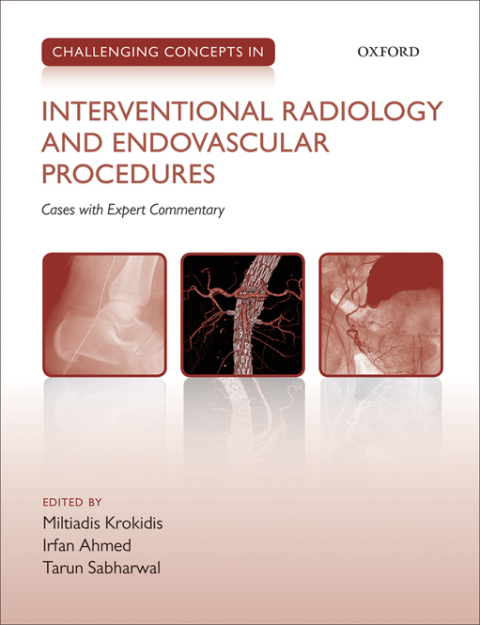 Challenging Concepts in Interventional Radiology, 1st Edition - FULL INSTANT DOWNLOAD | PDF DOCX EPUB
