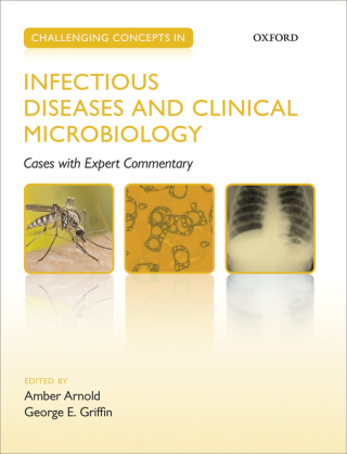 Immagine di copertina: Challenging Concepts in Infectious Diseases and Clinical Microbiology 1st edition 9780199665754