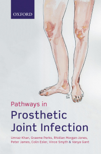 Imagen de portada: Pathways in Prosthetic Joint Infection 9780192509710