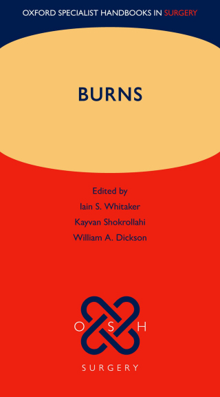 表紙画像: Burns 1st edition 9780199699537