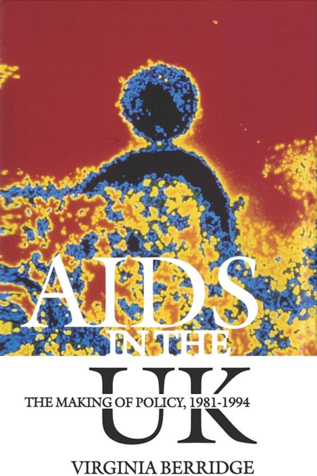 AIDS in the UK The Making of Policy, 1981-1994 1st Edition