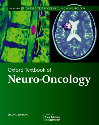 Cover image: Oxford Textbook of Neuro-Oncology 2nd edition 9780192642332
