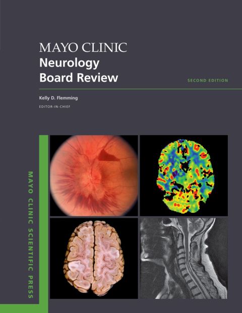 Mayo Clinic Neurology Board Review, 2nd Edition - FULL INSTANT DOWNLOAD | PDF DOCX EPUB