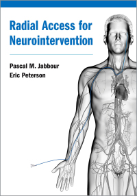 صورة الغلاف: Radial Access for Neurointervention 9780197524176