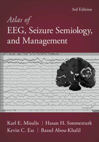 Titelbild: Atlas of EEG, Seizure Semiology, and Management 3rd edition 9780197543023