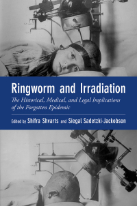 Titelbild: Ringworm and Irradiation 9780197568965