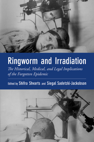 Immagine di copertina: Ringworm and Irradiation 9780197568965