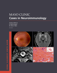 Omslagafbeelding: Mayo Clinic Cases in Neuroimmunology 9780197583425