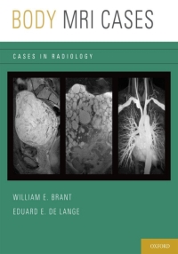 Cover image: Body MRI Cases 1st edition 9780199740710