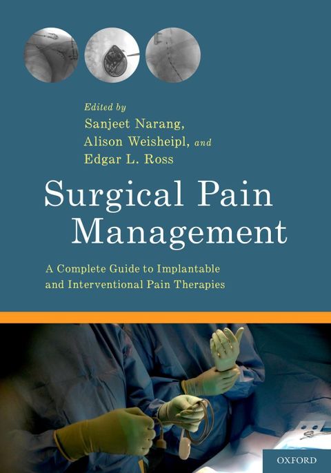 Surgical Pain Management: A Complete Guide to Implantable and Interventional Pain Therapies, 1st Edition - FULL INSTANT DOWNLOAD | PDF DOCX EPUB