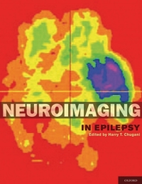 Cover image: Neuroimaging in Epilepsy 1st edition 9780195342765