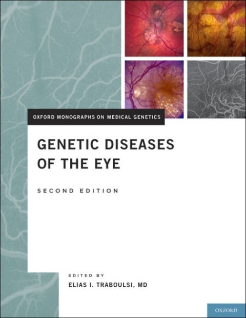 Genetic Diseases of the Eye - FULL INSTANT DOWNLOAD | PDF DOCX EPUB