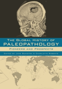 Imagen de portada: The Global History of Paleopathology 1st edition 9780195389807