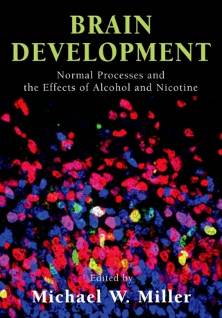 Imagen de portada: Brain Development 1st edition 9780195183139