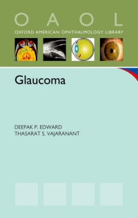 Cover image: Glaucoma 1st edition 9780199757084