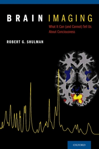 Cover image: Brain Imaging 9780199838721