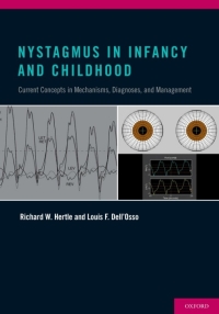 Titelbild: Nystagmus In Infancy and Childhood 9780199857005