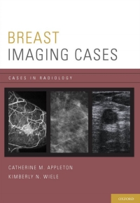 Cover image: Breast Imaging Cases 9780199731923