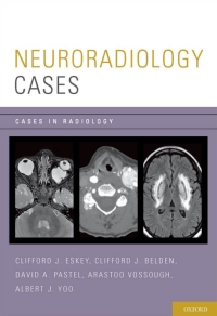 Imagen de portada: Neuroradiology Cases 9780199735983