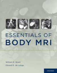 Cover image: Essentials of Body MRI 1st edition 9780199738496