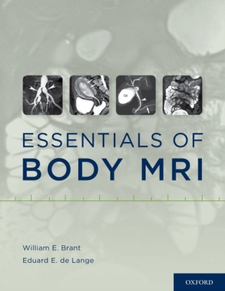 Imagen de portada: Essentials of Body MRI 1st edition 9780199738496