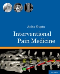 صورة الغلاف: Interventional Pain Medicine 1st edition 9780199740604