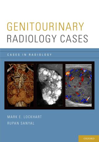 Cover image: Genitourinary Radiology Cases 1st edition 9780199975747