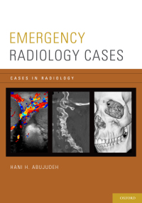 Cover image: Emergency Radiology Cases 1st edition 9780199941179