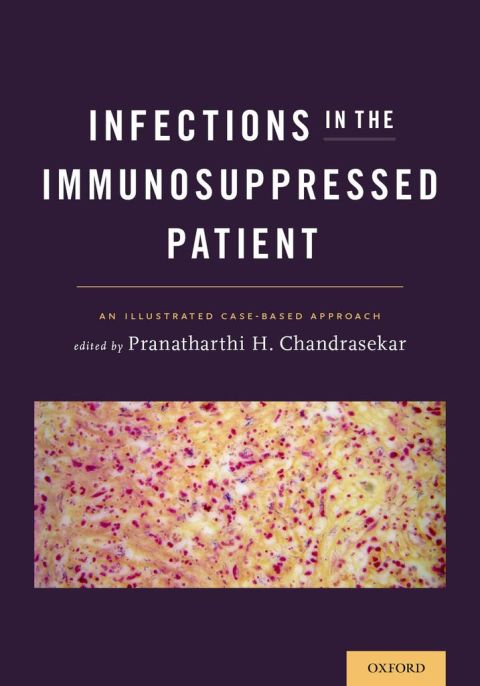 Infections in the Immunosuppressed Patient: An Illustrated Case-Based Approach, 1st Edition - FULL INSTANT DOWNLOAD | PDF DOCX EPUB