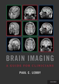 Cover image: Brain Imaging 9780199764679