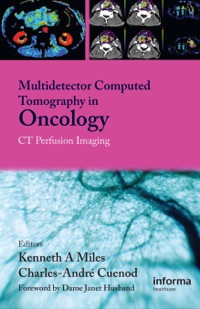 صورة الغلاف: Multi-Detector Computed Tomography in Oncology 1st edition 9781842143094
