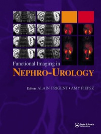 Immagine di copertina: Functional Imaging in Nephro-Urology 1st edition 9780367391270