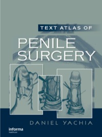 Titelbild: Text Atlas of Penile Surgery 1st edition 9781841845173