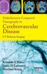 Cover image: Multidetector Computed Tomography in Cerebrovascular Disease 1st edition 9781842143155