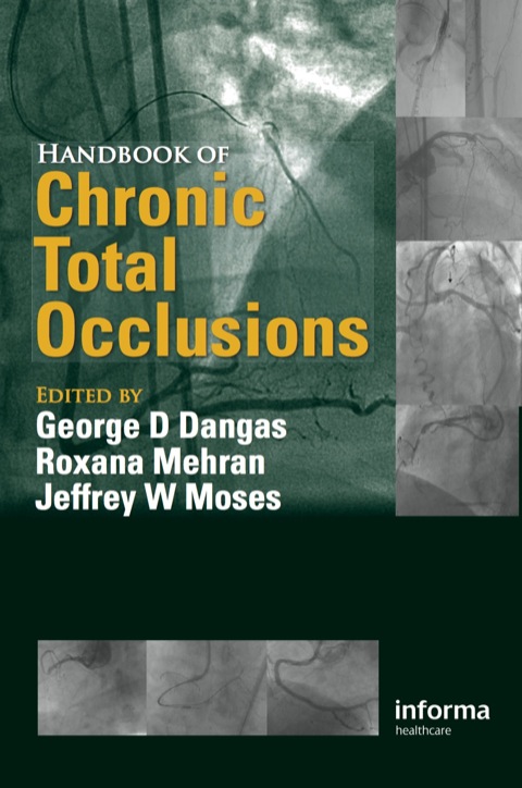 Handbook of Chronic Total Occlusions, 1st Edition - FULL INSTANT DOWNLOAD | PDF DOCX EPUB