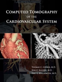 Cover image: Computed Tomography of the Cardiovascular System 1st edition 9780367387839