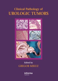 Cover image: Clinical Pathology of Urological Tumours 1st edition 9781841846194