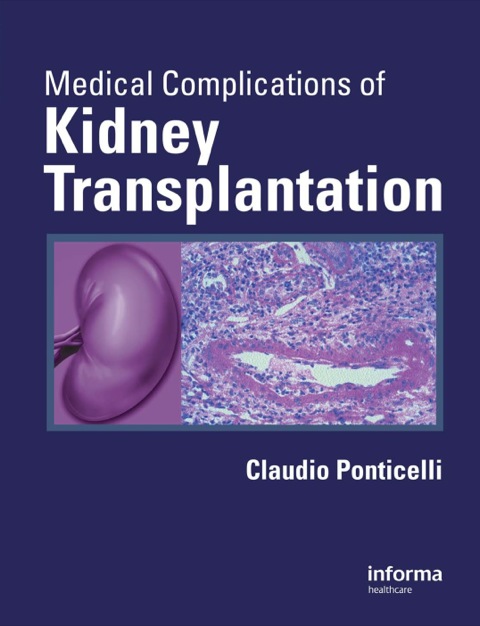 Medical Complications of Kidney Transplantation, 1st Edition - FULL INSTANT DOWNLOAD | PDF DOCX EPUB