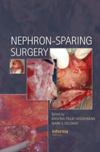Cover image: Nephron-Sparing Surgery 1st edition 9781841846361