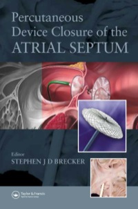 Cover image: Percutaneous Device Closure of the Atrial Septum 1st edition 9781841845968
