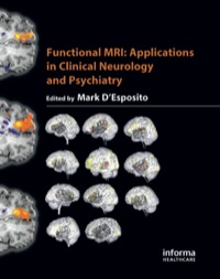 صورة الغلاف: Functional MRI 1st edition 9781842142950