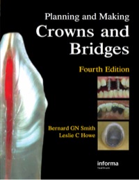 Cover image: Planning and Making Crowns and Bridges 4th edition 9780415398503