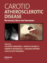Cover image: Carotid Atherosclerotic Disease 1st edition 9781841841496