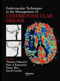 Immagine di copertina: Endovascular Techniques in the Management of Cerebrovascular Disease 1st edition 9781841846071