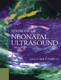Cover image: Textbook of Neonatal Ultrasound 1st edition 9781850709022