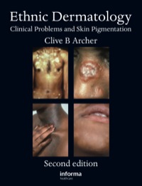 Cover image: Ethnic Dermatology 2nd edition 9780367386634